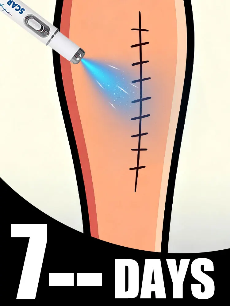 The latest scar technology, 2025 best-selling product