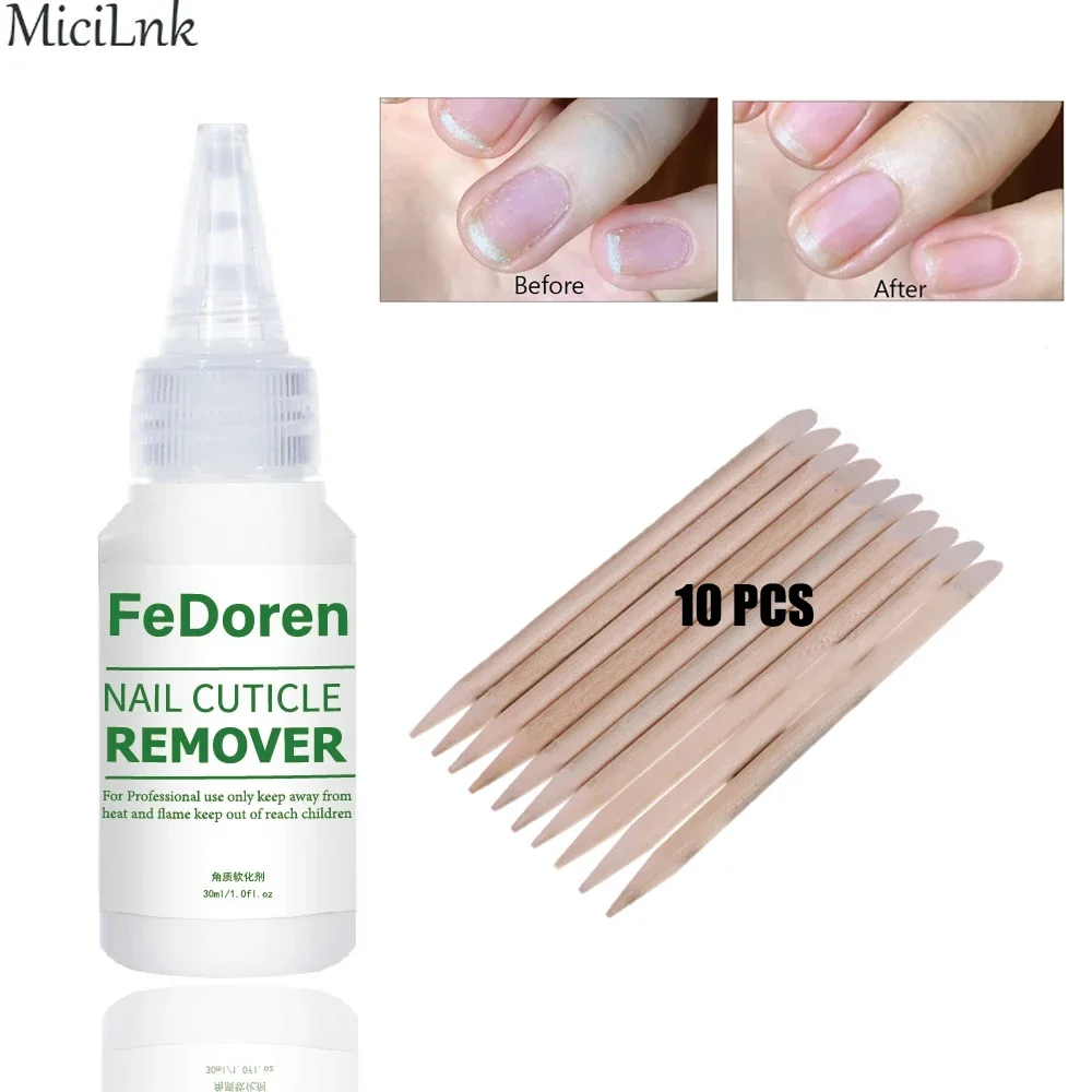 30ML Nail Cuticle Remover ammorbidente liquido per la riparazione delle unghie Gel esfoliante trattamento per cuticole Manicure ammorbidire la pelle morta per la cura delle unghie