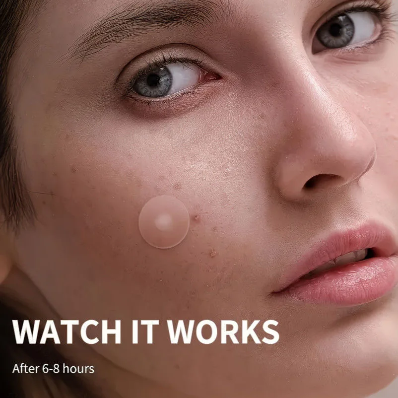 رقعة حب الشباب على شكل نجمة ودائرة، مناسبة لجميع المناسبات، طراز النجوم، 472 قطعة، حب الشباب الملون غير المرئي