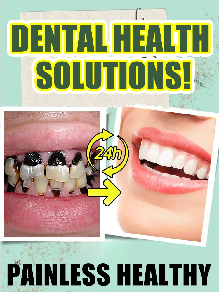

Tooth decay Repair Repairing Cavities Protecting Anti Caries