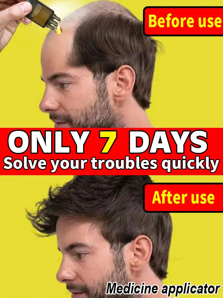 

Solve your hair trouble