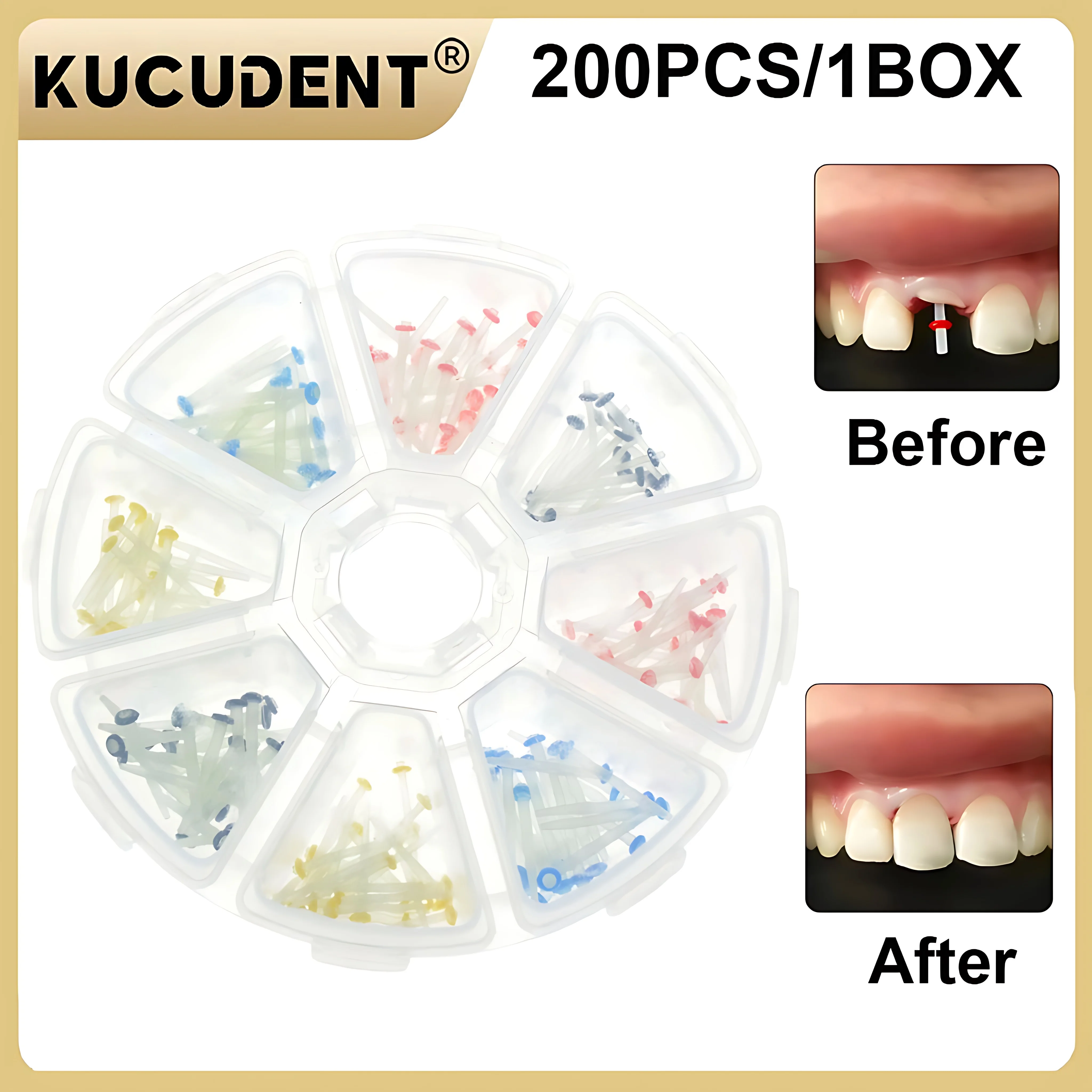 

KUCUDENT200 шт./кор. стоматологическое волокно, стекловолокно, смола, столб для корневых каналов, реставрационные материалы для наполнения зубов, разные размеры, 1,2-1,8 мм
