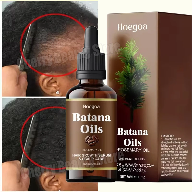 

Эфирное масло для ухода за волосами Batana, розмарина, питание, увлажнение, улучшение качества волос, уменьшение выпадения волос, предотвращение разделения волос, средство для ухода за волосами