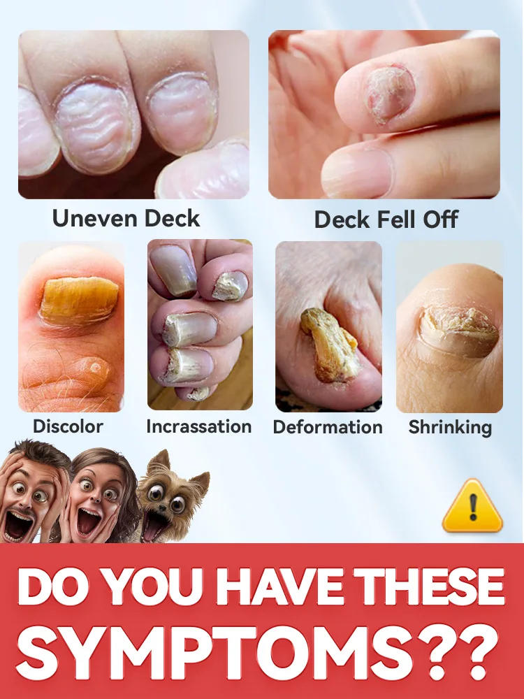 Are you still worried about your nail health?