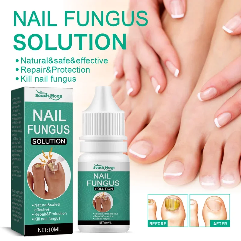 30ml nail fungus treatment gel herbal nail polish foot protection skin care oil repair cream foot nail polish repair products