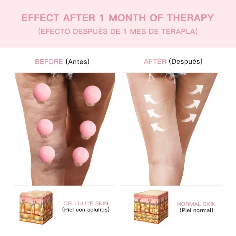 Vacuum Cupping Cups Massage Anti Cellulite Skin Lifting Vacuum Suction Cupping Cups for Body Face Muscle and Joint Massage Jar