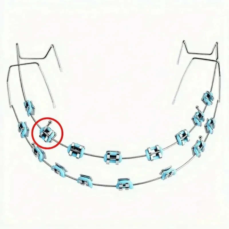 Fashion Braces Colorful 1 Pair Temporary Tooth Decoration with Metal Wires Metal Bracket Orthodontic Ligature Ties High Quality