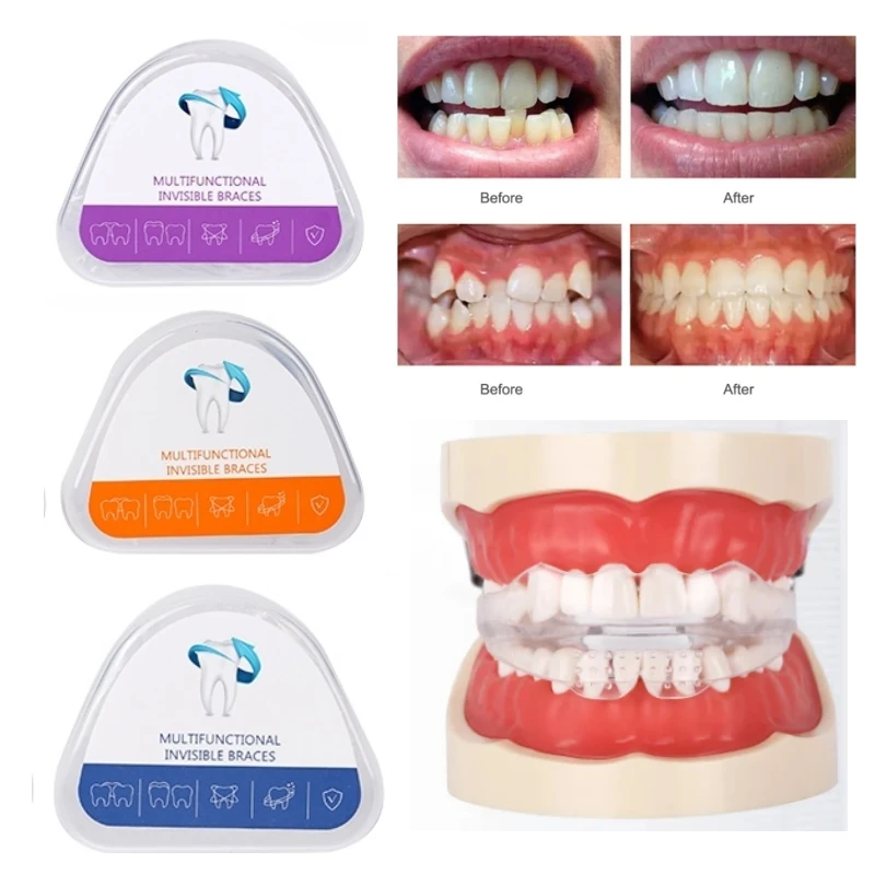 Appareil orthodontique dentaire en 3 étapes, gouttière d'alignement en silicone, rétention dentaire, protège-dents anti-bruxisme, redresseur buccal