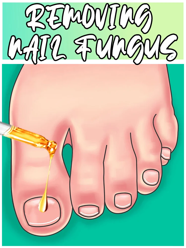 

Fungus Prevention Technology - Adjustable Temperature Control and Safety