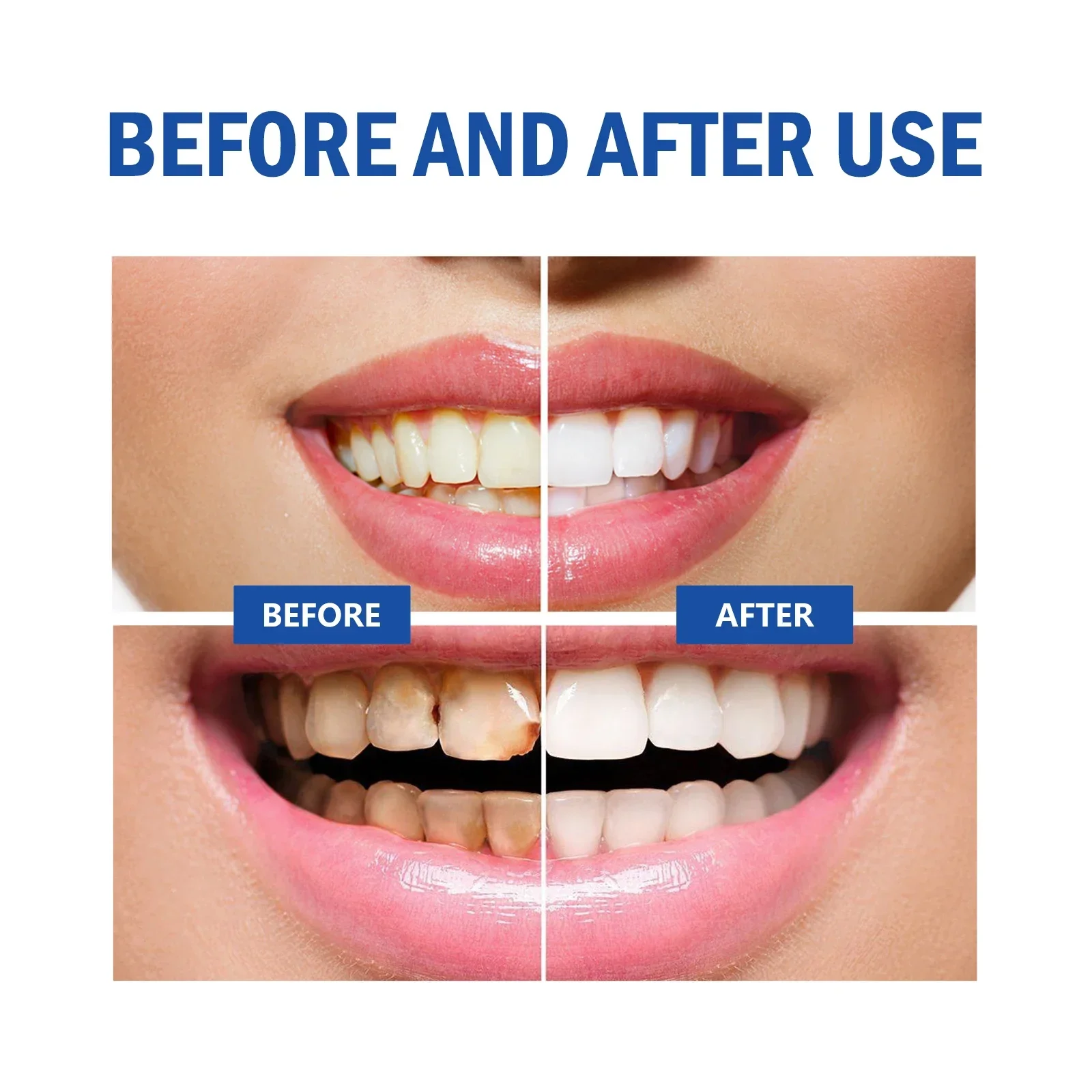 5pcs Teeth Whitening Powder Removes Yellow Teeth Toothpaste Freshens Breath Protects Gum Health Deep Cleaning Tools Dental Care