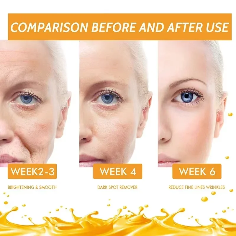 Vitamina c remover manchas escuras soro clareamento anti-rugas ageless firme cuidados com a pele desvanece-se melanina iluminando tom da pele cosméticos