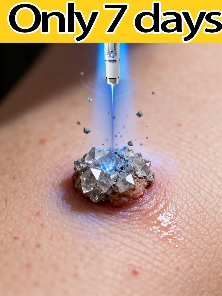 

Hᴏᴛ sᴇʟʟɪɴɢ ʙʟᴜᴇ ʟɪɢʜᴛ ᴘᴇɴ ᴛᴏ sᴏʟᴠᴇ ʙᴏᴅʏ ᴡᴀʀᴛs, ᴡᴀʀᴛ ᴄᴀʀᴇ ᴛᴏᴏʟs