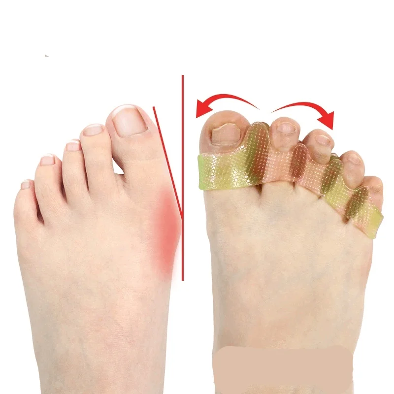 Thumbnail 4 - #5 Trending Pedicure Spacers Right Now