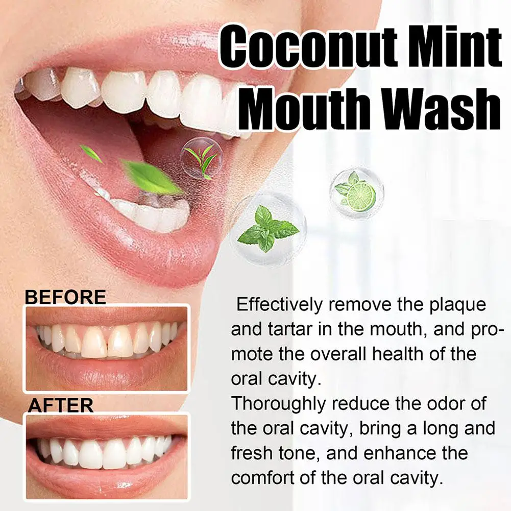 100ml Coconut Oil Mint Pulling Oil Mouth Wash Alcohol-free Oral Whitening Scrape Tongue Breath Clean Teeth Oral U0Y4