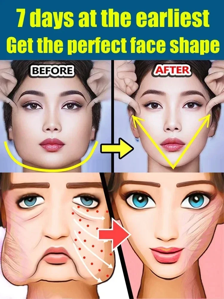 Double Chin V Shape Remove The face fat