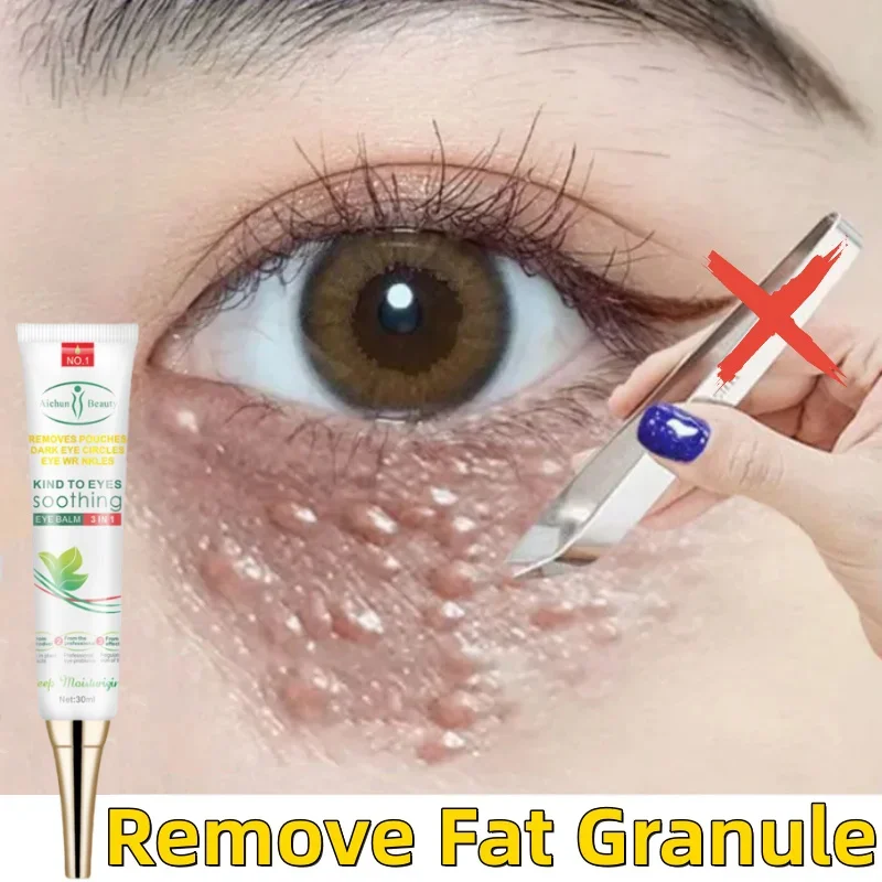 

Fat Granules Remover Eye Cream Remove Dark Circle Anti-Puffiness Firming Cream Antiaging Fade Fine Line Repair Skin Barrier Care