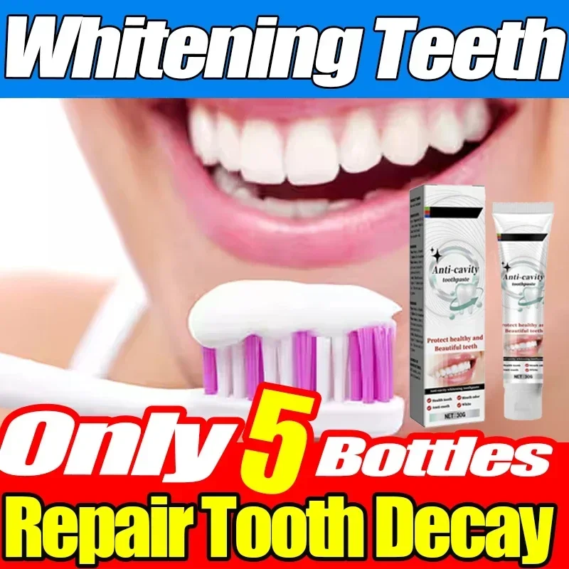 New Dental Calculus Remover Toothpaste Whitening Teeth Mouth Odour Removal Bad Breath Preventing Periodontitis Dental Cleaning