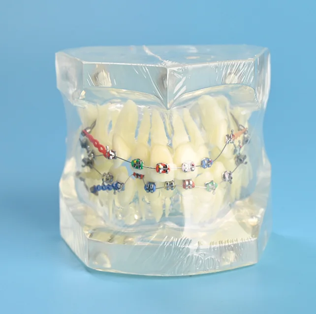 

Dental Oral Care Tooth Teeth Model Dental Orthodontic Model for Patient Communication Dentist Study Model