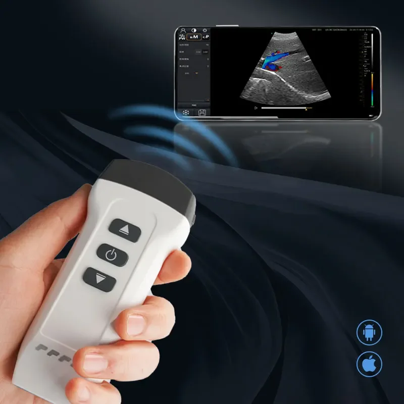 DW-X1 portable ultrasound machine dual head wireless ultrasound probe compatible with iOS and Android system