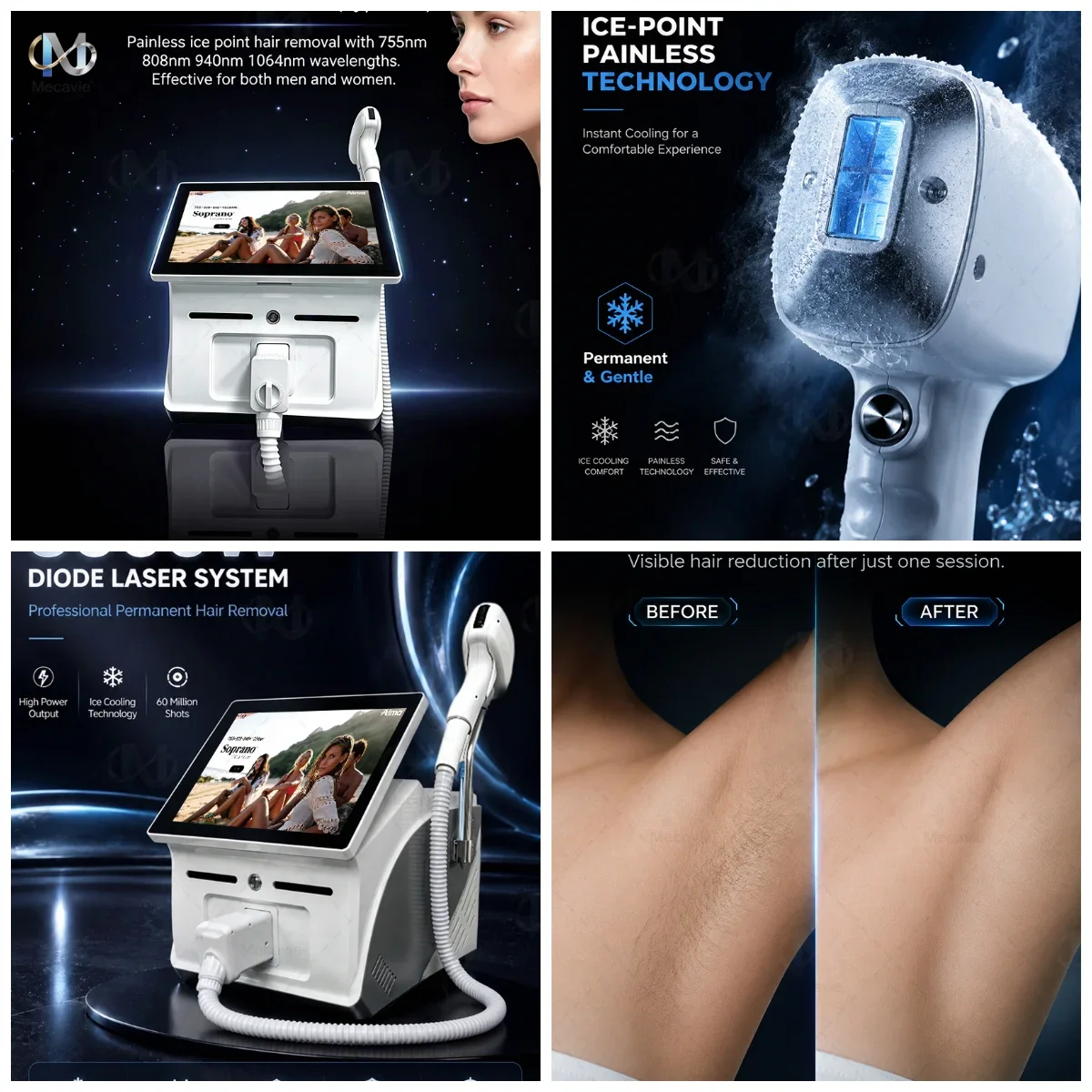 4 Wave 808Nm Skin Rejuvenation Ice Platinum Depilacion Diode Laser Hair Removal 4000w Machine 15.6-inch Large Operating Screen