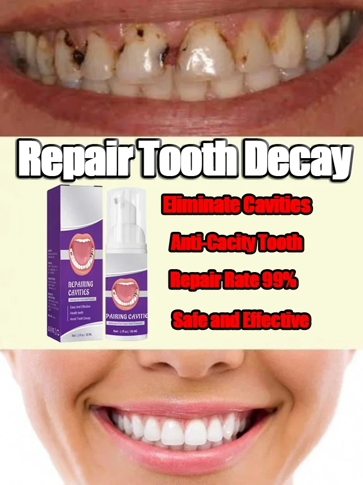 

Effective Teeth Whitening Tooth decay repair Calculus Plaque Periodontitis Remove Cavities