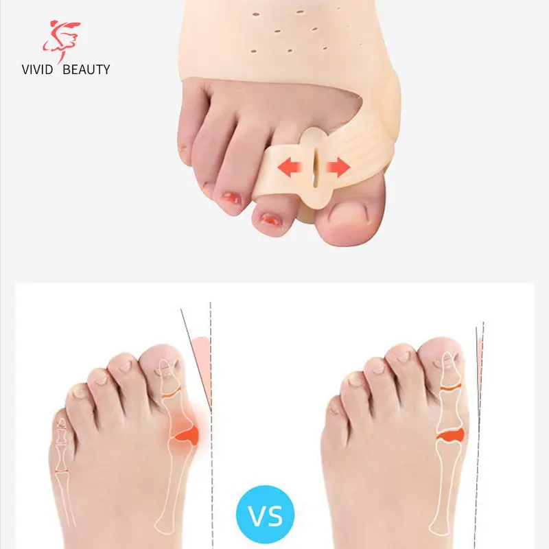 2 Stuks Siliconen Bunion Corrector Teen Separator Teen Teen Valgus Voor Teen Haluksy Vinger Separator Hallux Valgus Corrector