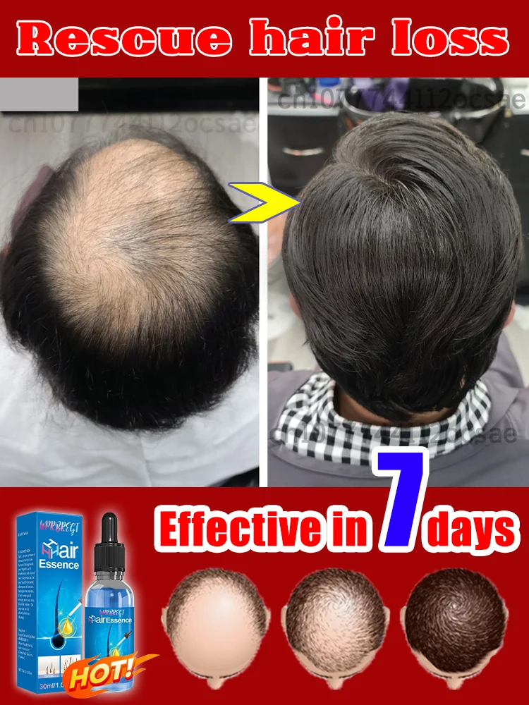 

Hair growth products, free shipping, keep away baldness and hair loss, accelerate hair growth