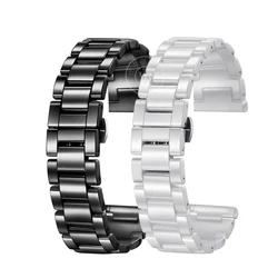 New Stlye Watchbands 20mm men's and women's bracele Ceramic Series Quick Release Watch Strap