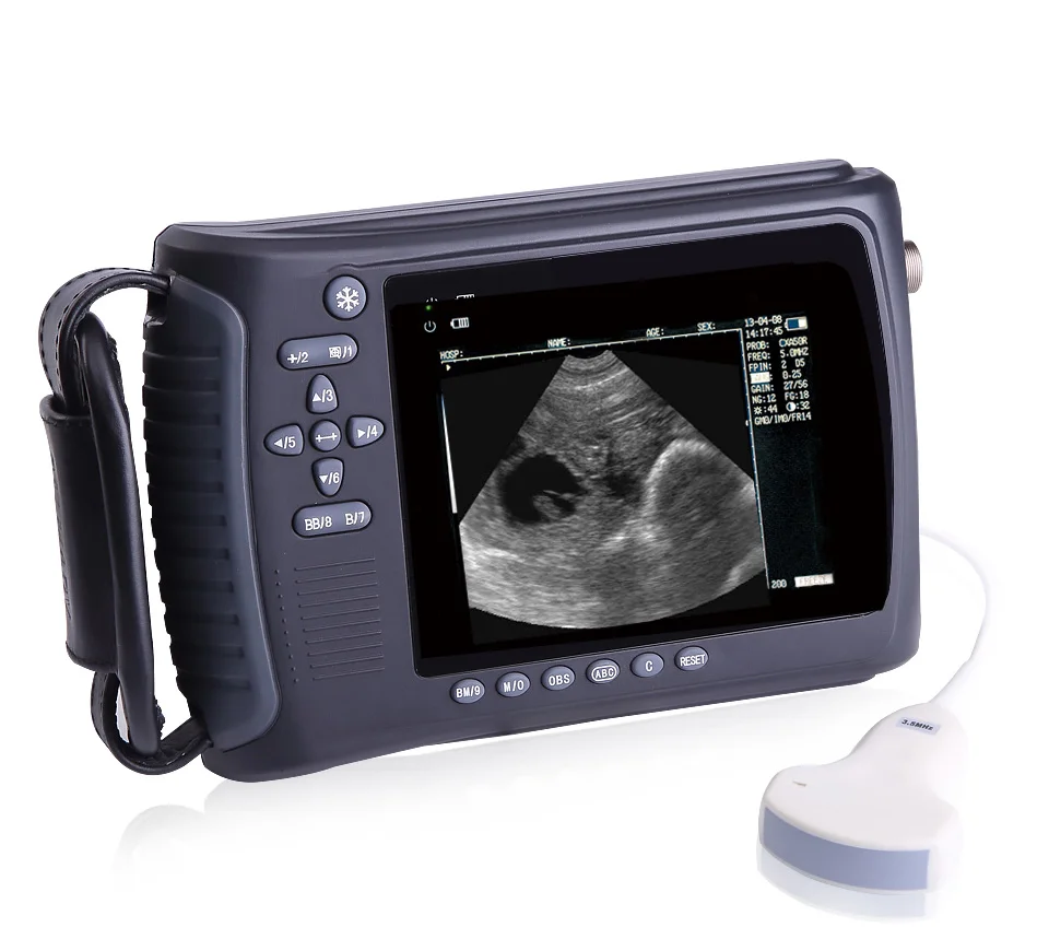 Medical Supply Veterinary Ultrasound Scanner with Dynamic Range Optional Probes for Scan Examination