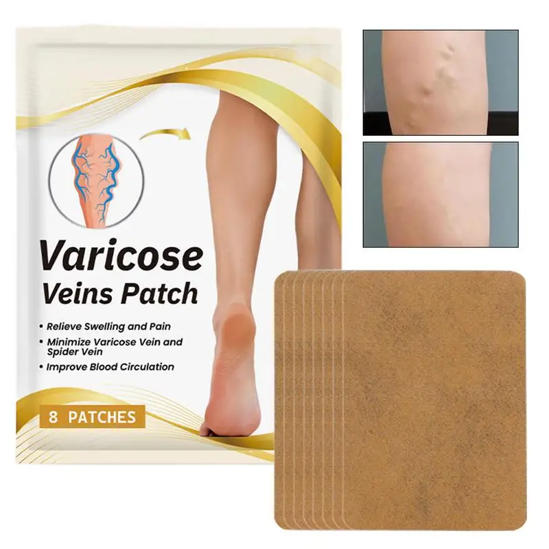 8Pcs Vein Care Patches Vein Relief  Eliminate Vasculitis Phlebitis Spider Improves Blood Circulation Relieve Spider Legs Care