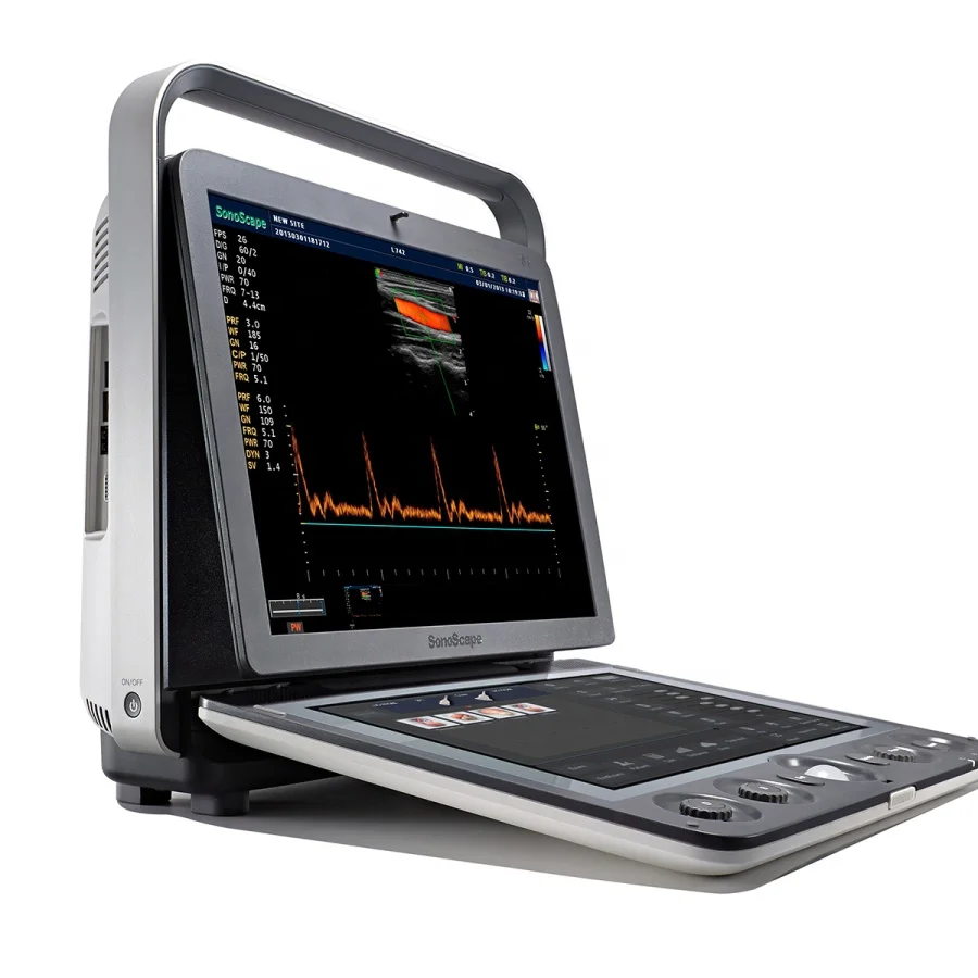 SonoScape Ultrasound Machine 3D 4D Echography Ultrasound Machine Portable