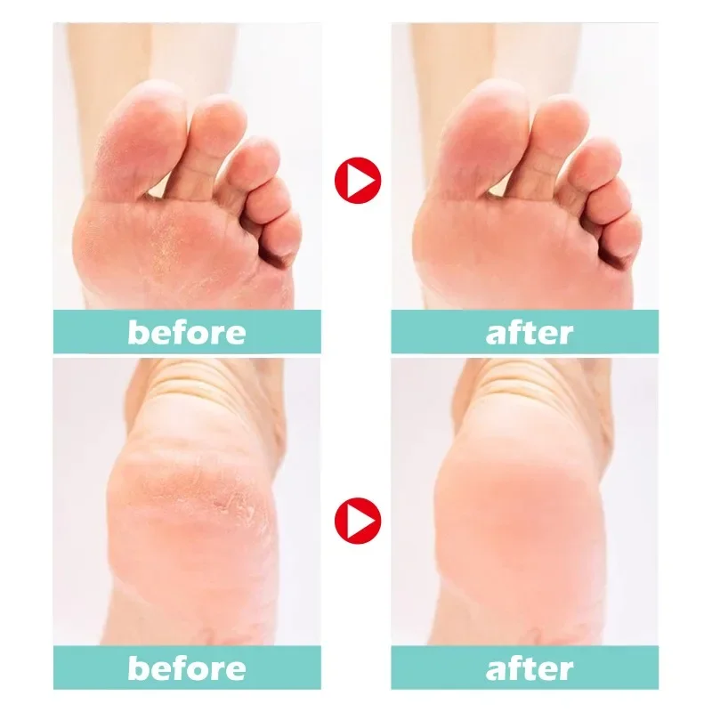 Sdotter New Foot Cream Repair Dry Peeling Cracks Heels removal Callus Dead Skin Anti chapped exfoliation Moisturizing hydrating