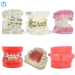 Dental Model With Metal Brackets Dental Teaching Resources Model for Dentist Student Restoration Correction Practice