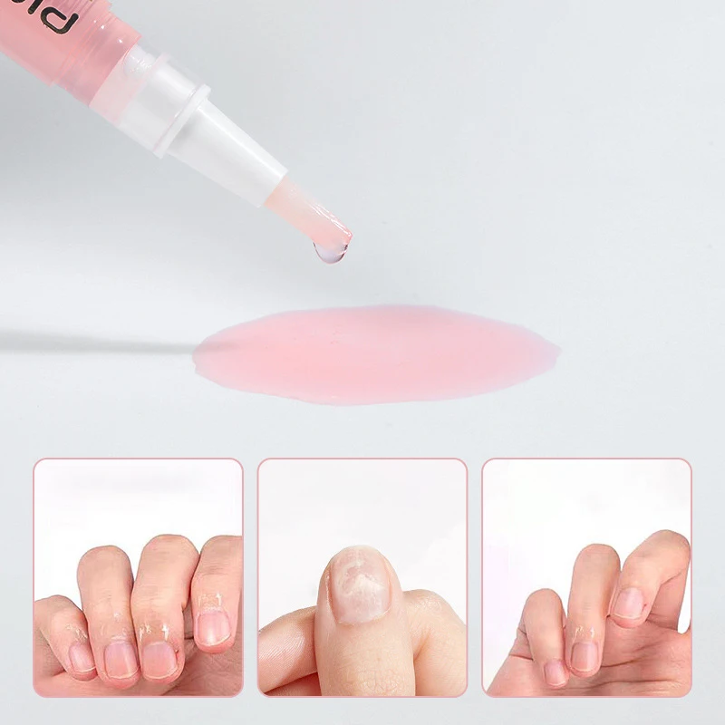 Olejek do paznokci w pisaku, uroczy olejek do skórek, pisak do naprawy paznokci, do pielęgnacji paznokci, prezent, profesjonalny salon