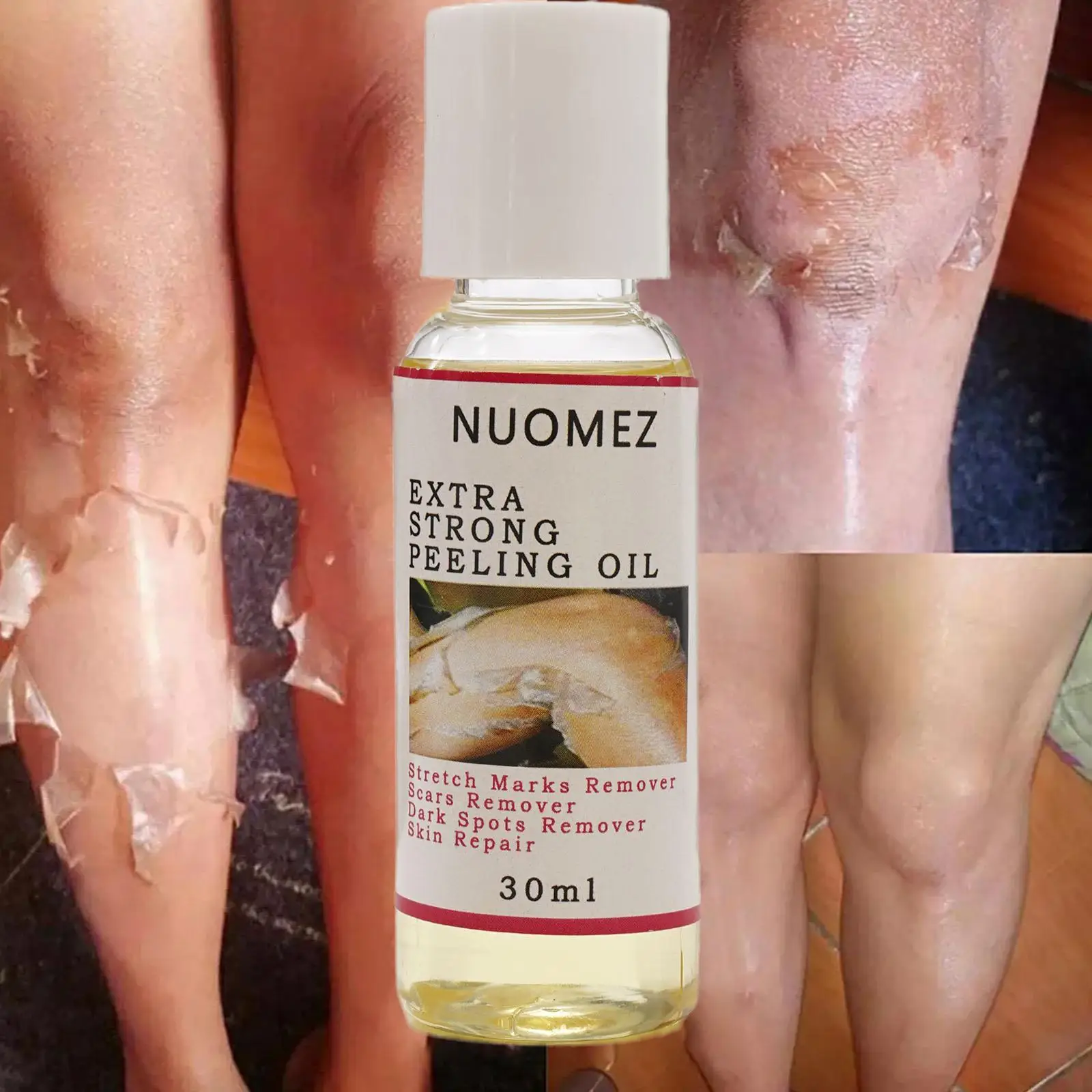 Aceite Exfoliante para piel oscura, aceite exfoliante fuerte, Hidratante para iluminar la piel, elimina los codos, las rodillas y las manos