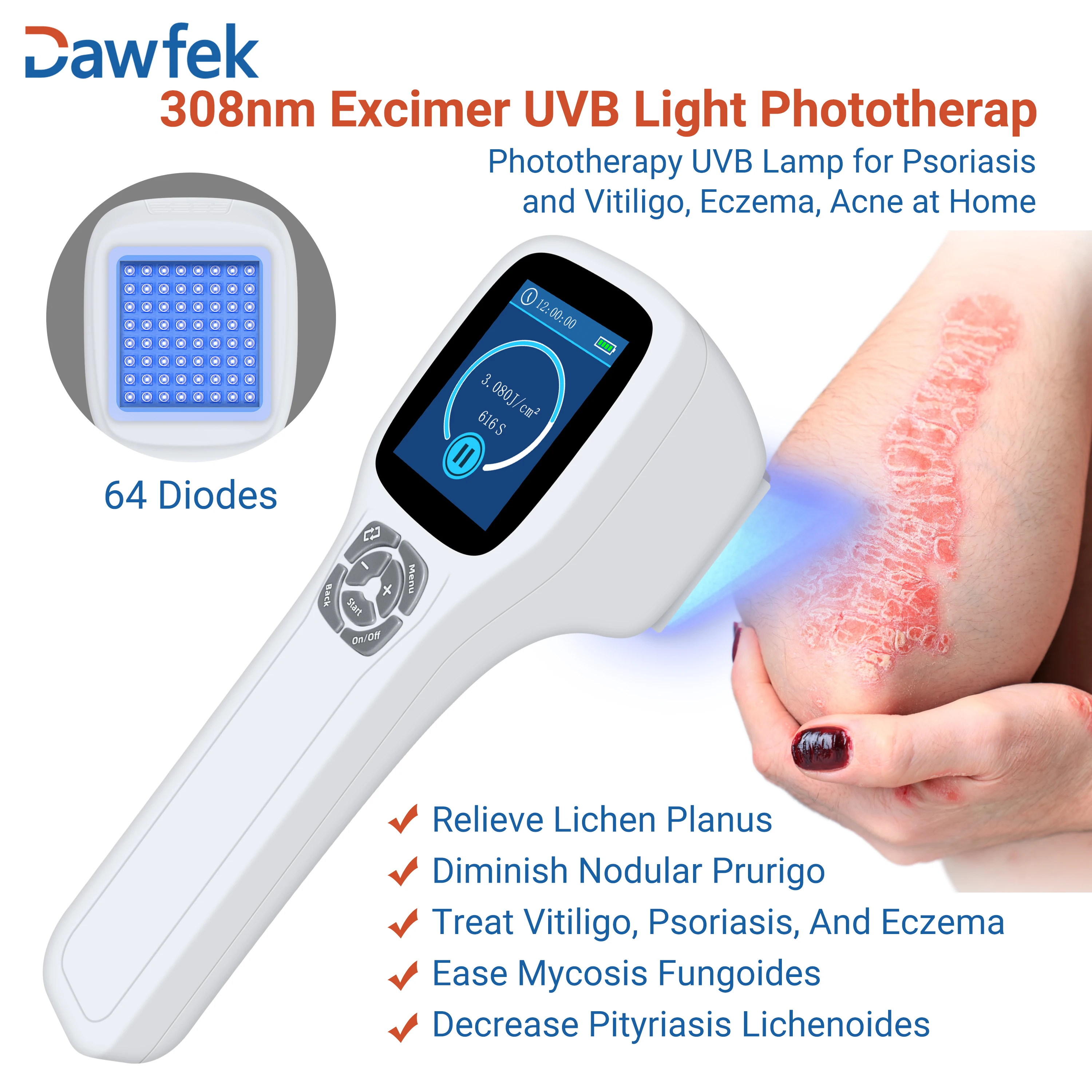 Dawfek Uvb Light Therapy For Vitiligo Home Phototherapy Uvb Lamp Treating Vitiligo And Contact Dermatosis Folliculitis