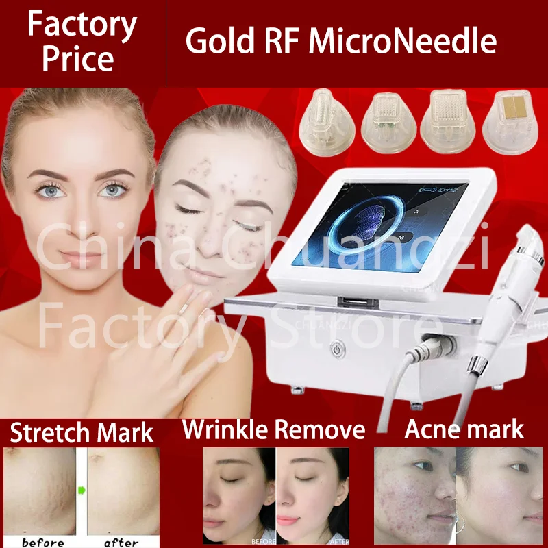 

Портативный morpheus8professionalmachineRadioFrequencyGold RFMicroneedleskinLifting AndTighteningAnti-AgingAcneRemova