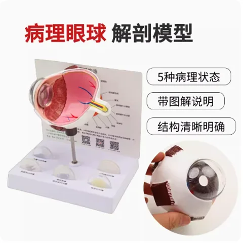 

Подлинная высококачественная профессиональная версия, анатомическая модель человеческого глаза, анатомия глаз, функции лица, офтальмологическая модель