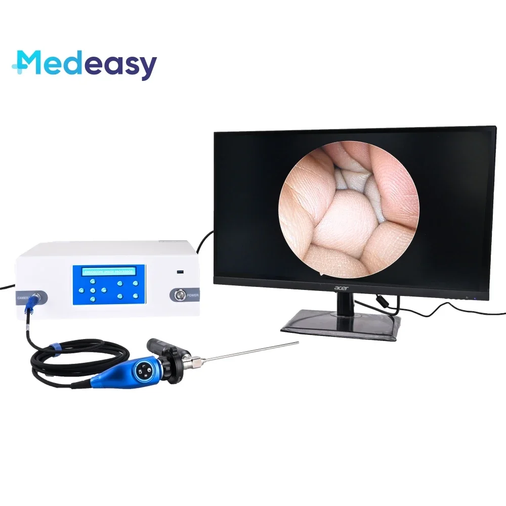 Full HD 1080P Endoscope Equipment with Endoscopy Camera with Photo Video Record Function