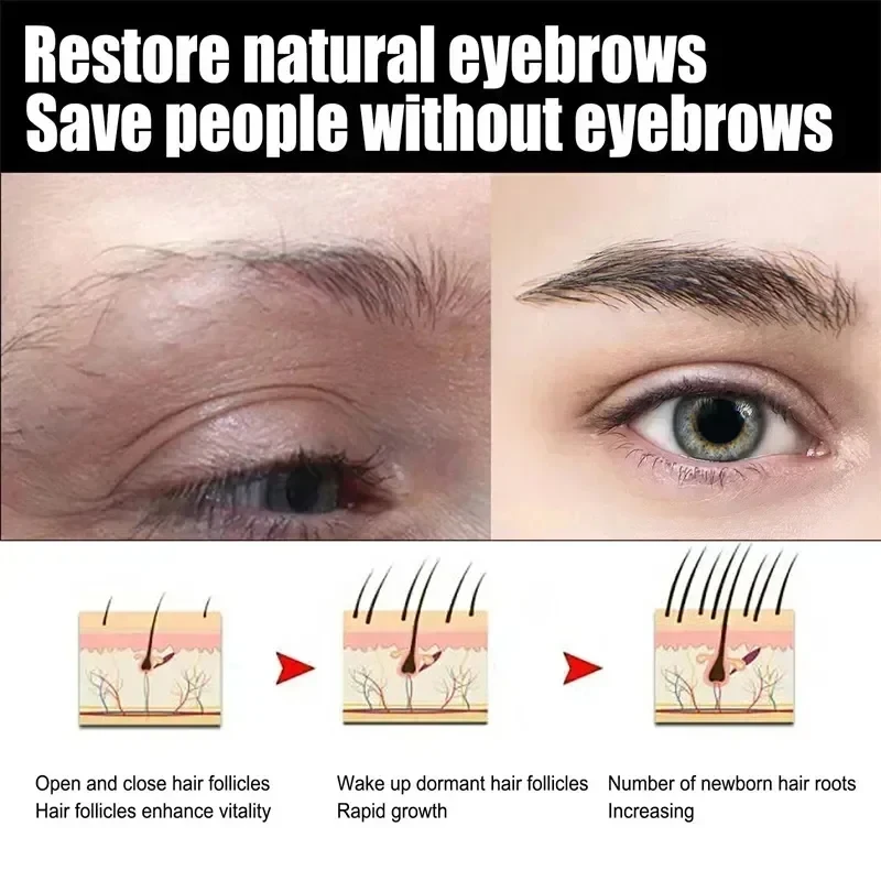 Eyebrow Hair Growth Solution Rapidly Grows Eyebrows And Promotes The Growth Of Hair Follicles Provides Rich Nutritional Elements