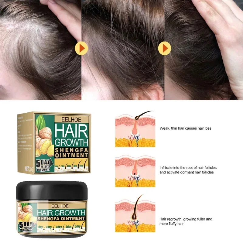 Hair Growth Cream Ginger Alopecia Regrowth Repairing Prevent Hair Loss Baldness Treatment Dense Strengthener Hair Care Products