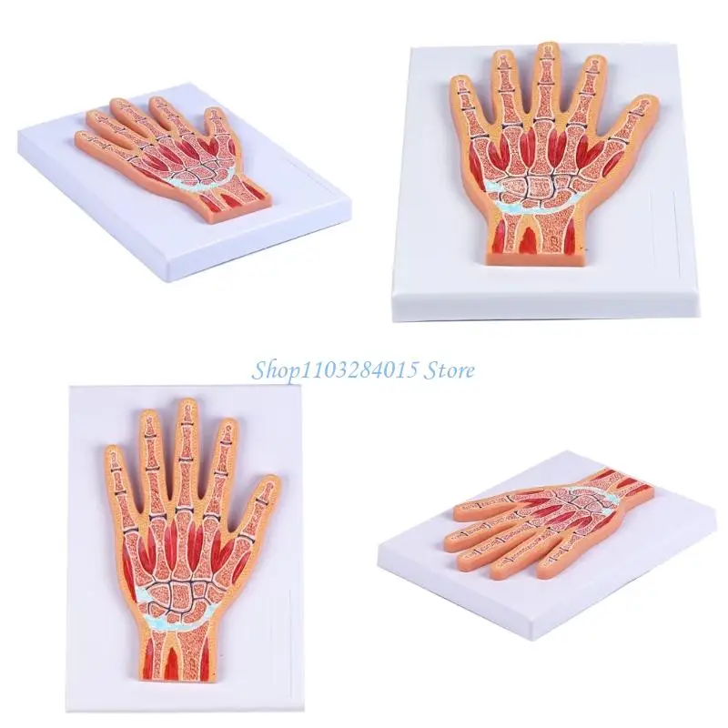 R6FF Multi Layer Disassemblable Wrist Joint Anatomical Model For Learning Anatomy