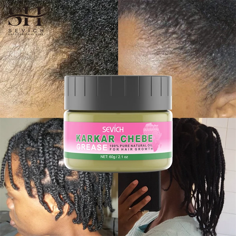 karkar Fast Hair Growth Sevich Traction Alopecia Hair Karkar Oil Anti Hair Break Hair Strengthen Hair Loss Care Repair Damage