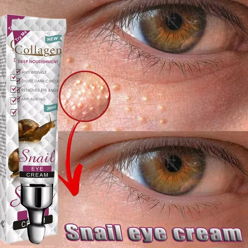 Fat Granules Remover Eyes Cream Improve Eye Bag Fades Fine Lines Moisturizing Anti-Puffiness Lifting Firming Skin Care Products