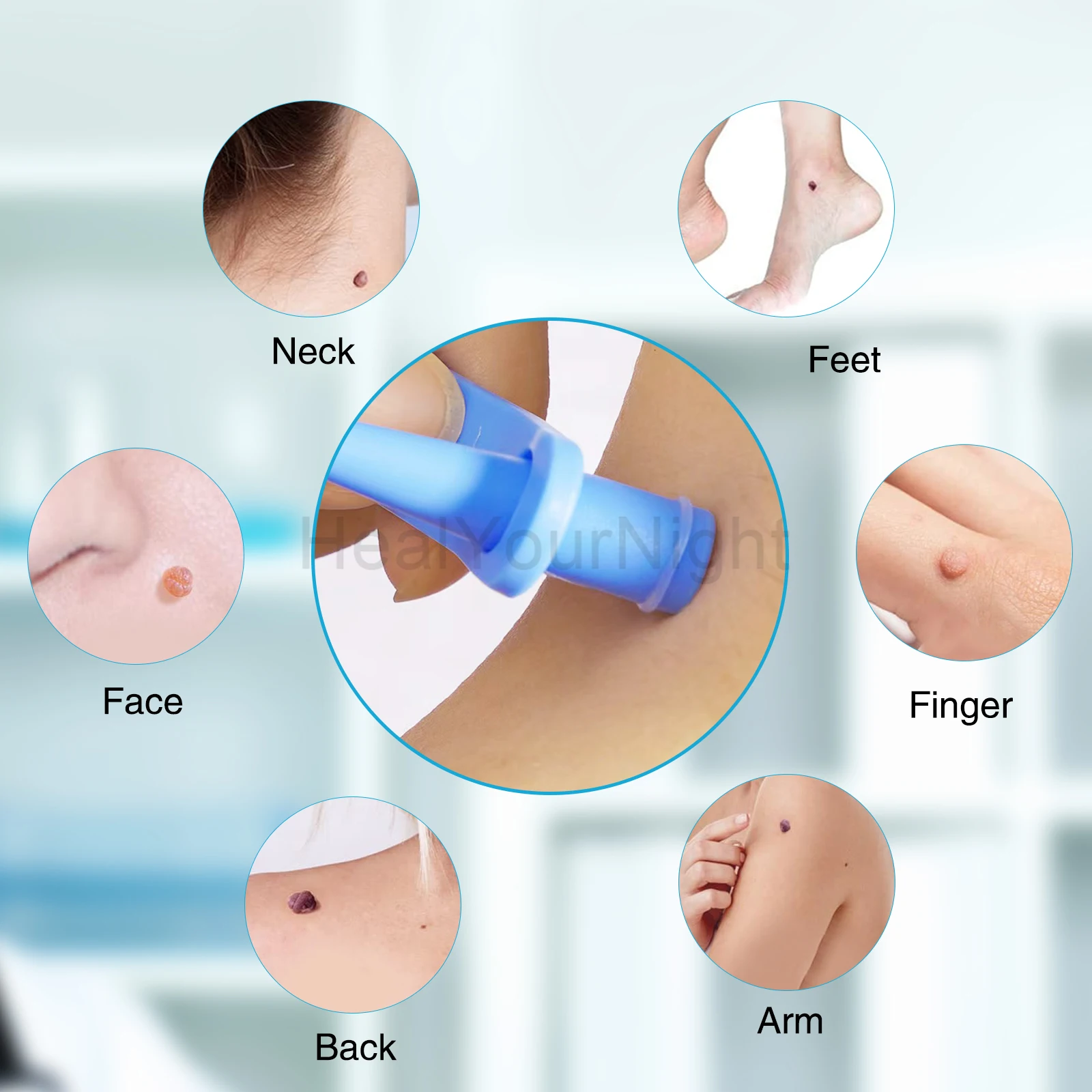 เครื่องมือดูแลความงามบนใบหน้า 3-IN-1 Auto Skin Tag Removal Kit ไม่เจ็บปวดผิวป้าย Mole สิวกําจัดหูดชุดปากกาทําความสะอาด Swabs