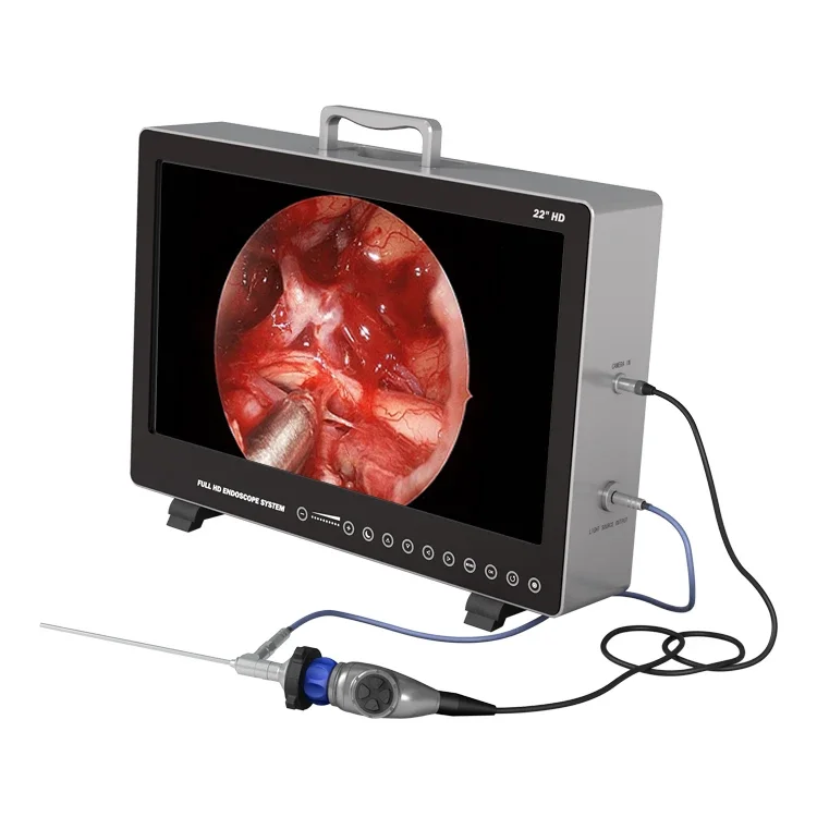 Factory Price Medical 22 inch Portable Full HD Endoscope  System