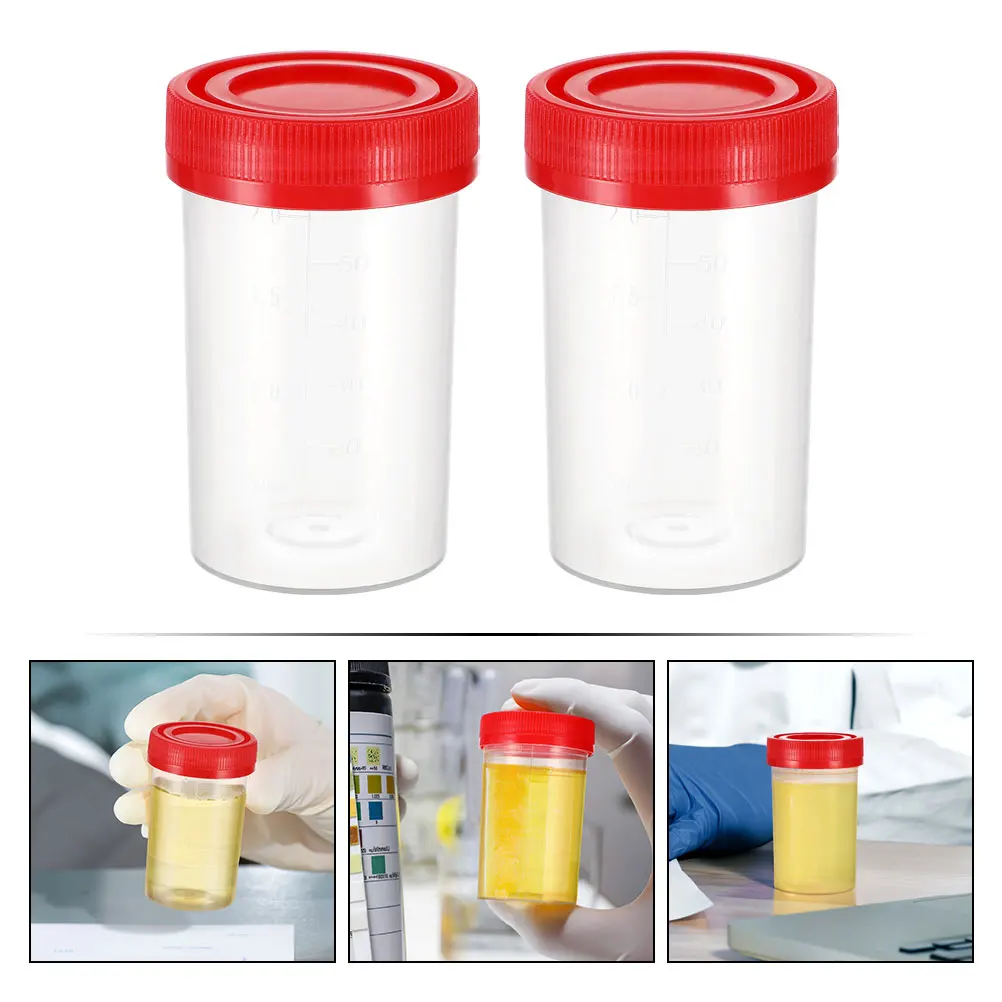 50 Pcs Stool Cup Urine Plastic Specimen Sampling Bottle for Liquid Sample Cups with Lids Disposable Lab Containers