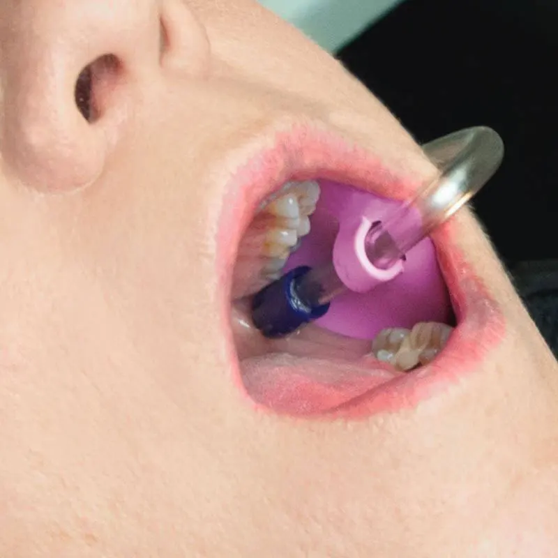 50 قطعة/الحقيبة أنبوب شفط الأسنان حامل أنبوب اللعاب القاذف HVE أنبوب الموضع الأوتوكلاف #4