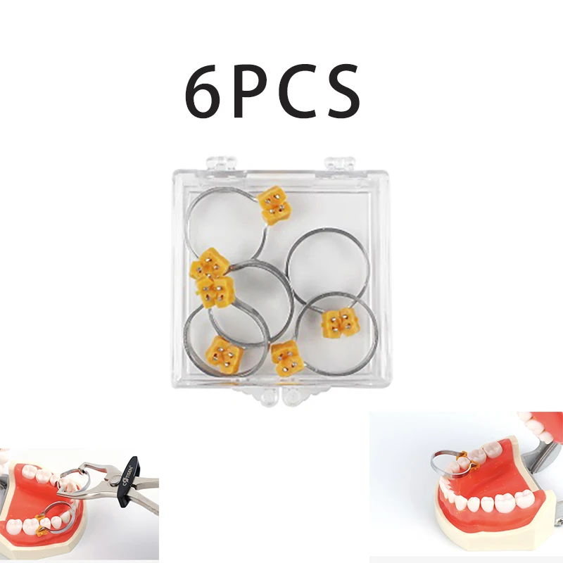 6Pcs/box Autoclavable Dental Matrix Ring Kit Silicone Vertical Triangular Matrix Clamp for Composite Interproximal Restoration