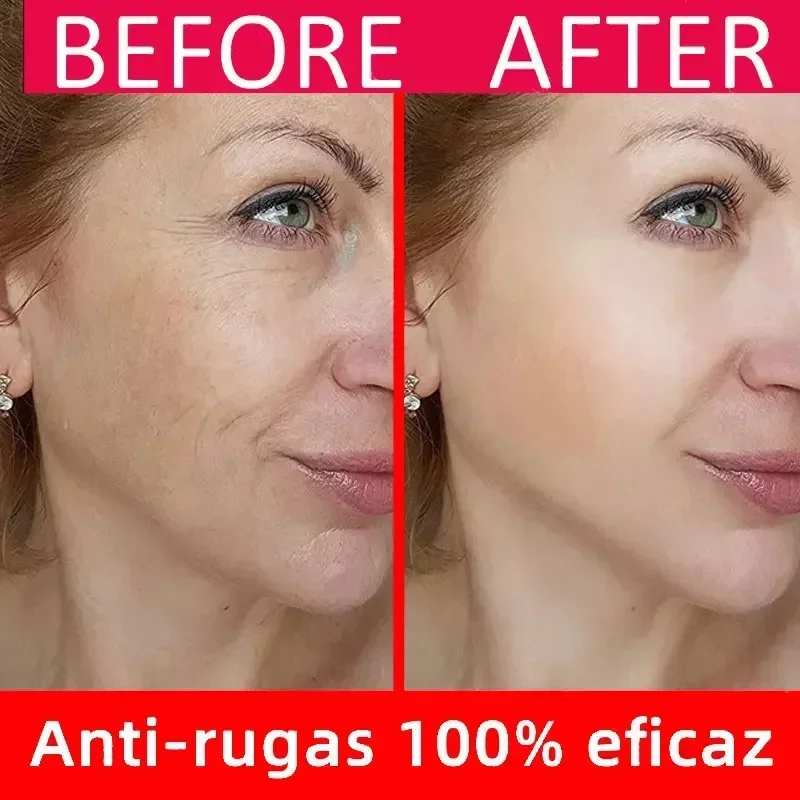 Rosto hidratante anti envelhecimento soro anti-rugas soro facial remover rugas linhas finas ao redor dos olhos corvo pés pescoço rugas